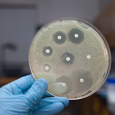 Fortalecimiento de la gobernanza de la resistencia antimicrobiana en Europa