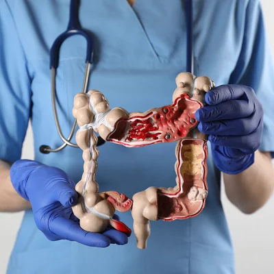 Patrones temporales de alimentación y cáncer colorrectal