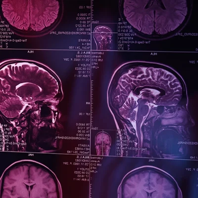 Plan Integral de Alzheimer y otras Demencias